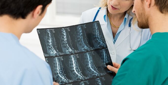 Radiographie de la colonne vertébrale pour diagnostiquer l'ostéochondrose